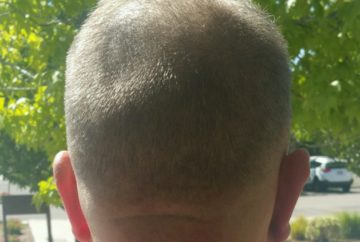 Skin Fade Back